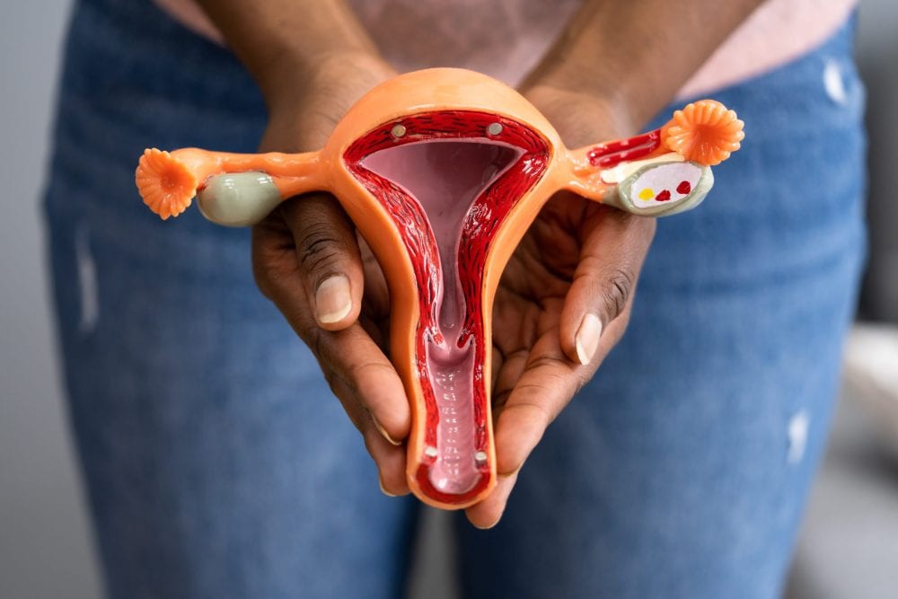 Hysterectomy