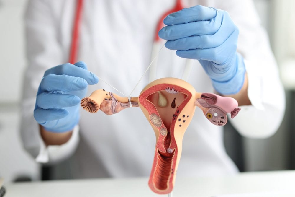 Tubal ligation